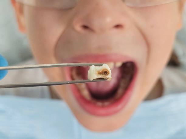 Best Emergency Dentist Near Me  in Sistersville, WV